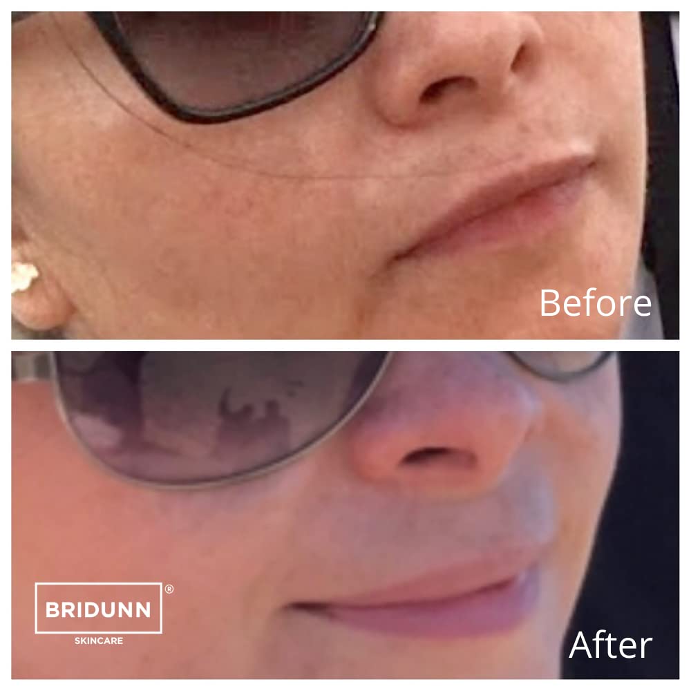 BRIDUNN SKINCARE KIT - Conjunto Suero Piel Radiante: Crema Facial Despigmentante quitamanchas y Suero Antioxidante con Karité | Elimina Manchas, Aclara el Tono y Previene el Envejecimiento | Natural y Libre de Químicos, para Todo Tipo de Piel