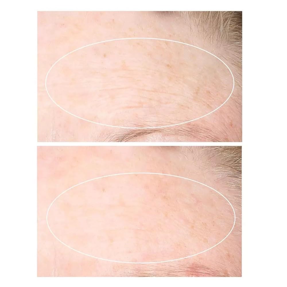 StriVectin Anti-wrinkle SD advanced Plus. Intensive Moisturizing Concentrate for wrinkes & stretch marks with collagen - CE Complex Incluye 2 envases de 47 ml / 1.6 fl oz cada uno
