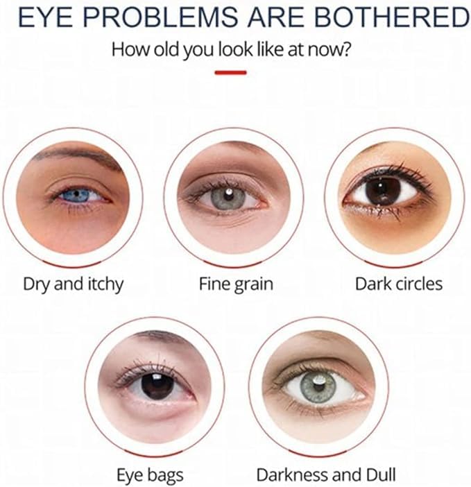 TXYakoc 2024 New OpenEyes Awaken Peptide Lifting Eye Gel - Reduce Puffiness and Dark Circles - Set of 5 x 15g