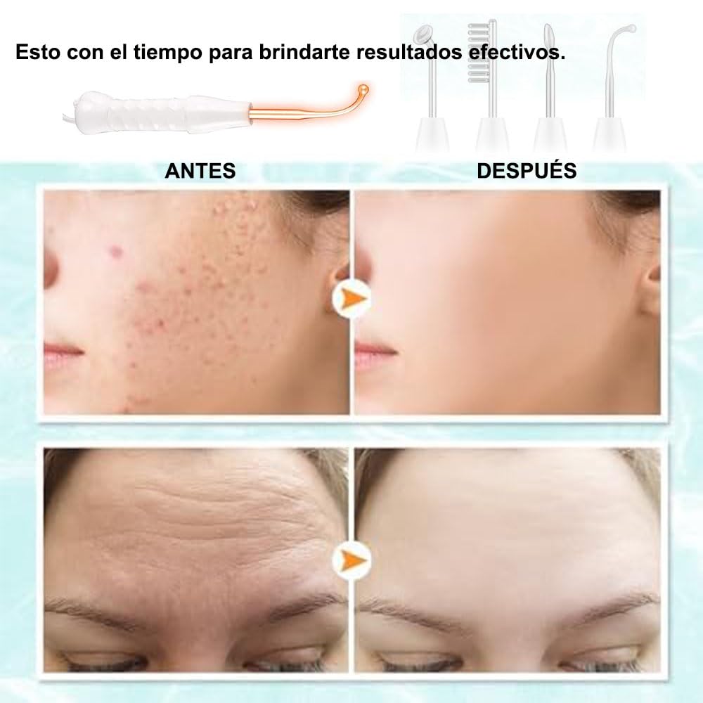 Radiofrecuencia Facial Alta Frecuencia Portable con Electrodos y Herramientas para Eliminar Acné