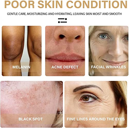 Serum Reparador de Manchas Oscuras de Cúrcuma - Tratamiento para Melasma - 2 Unidades - ¡Ilumina tu piel!