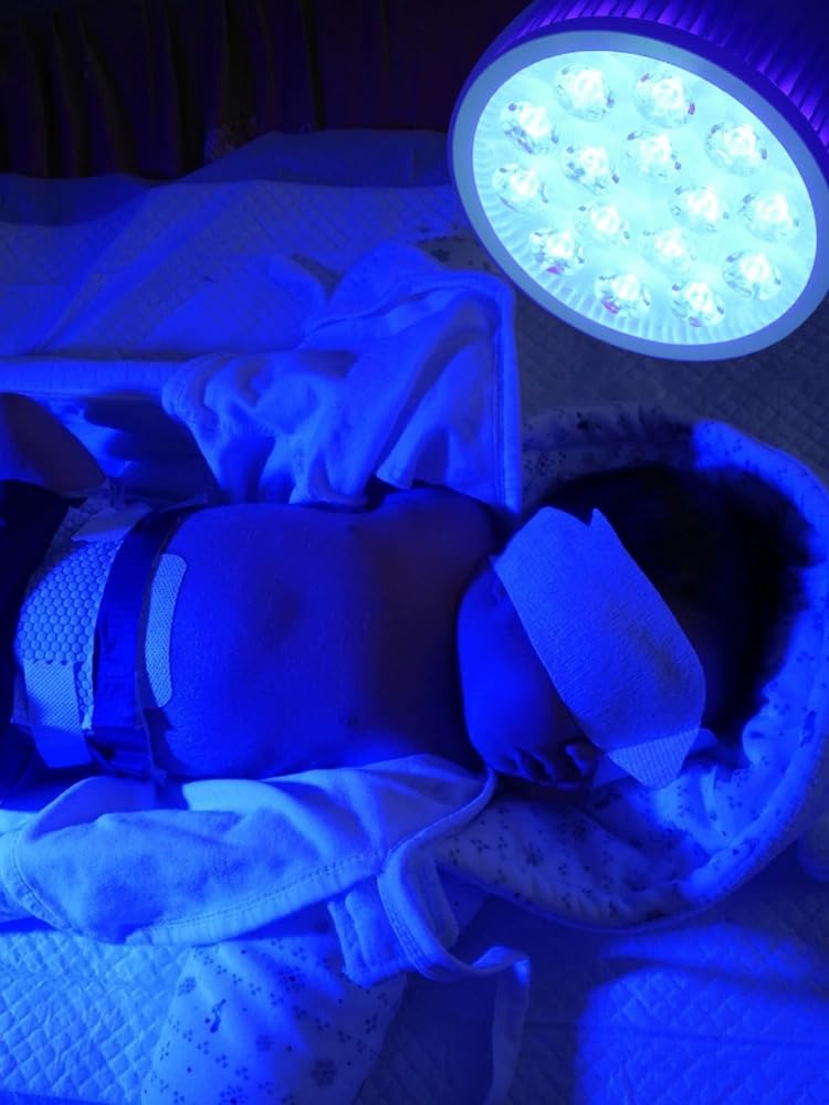 Lámpara Terapia De Luz Stickfrease Azul Portátil con 18 Chips Led para Bebé Recién Nacido