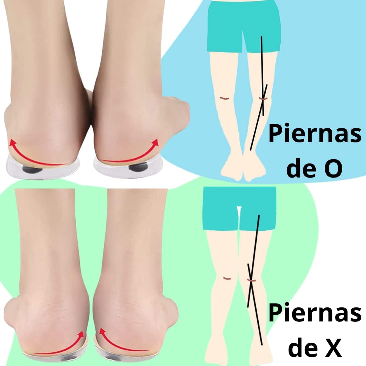 Plantillas Ortopédicas VERALY.MX Silicon Pie Pronador Imanes para Corrector de Supinación y Pronación