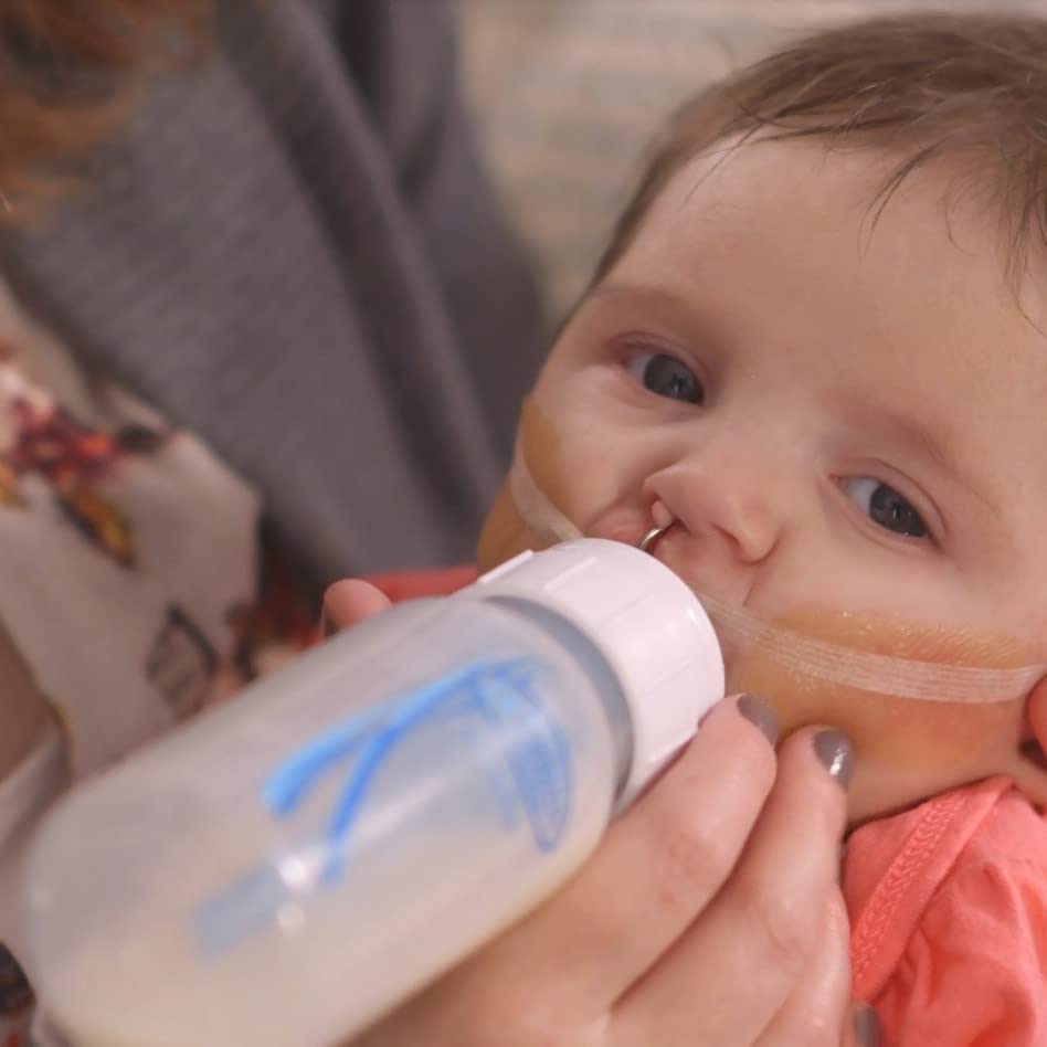 Dr. Brown's Medical Specialty - Sistema de alimentación de biberón estrecho, válvula de alimentación de ritmo infantil, solución de alimentación oral para bebés con labio hendido, corbata de lengua,