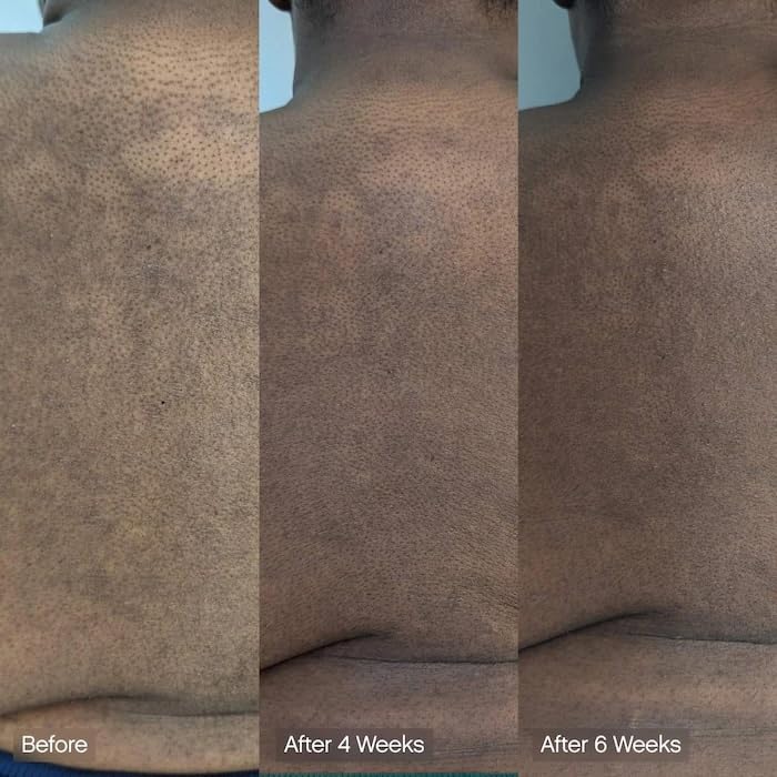 Topicals Jabón Limpiador Facial Y Corporal Faded | Ácido Kójico, Vitamina C Y Ácido Láctico | Hidrata | Vegano, Sin Perfume, Apto Para Pieles Sensibles (Paquete De 2)