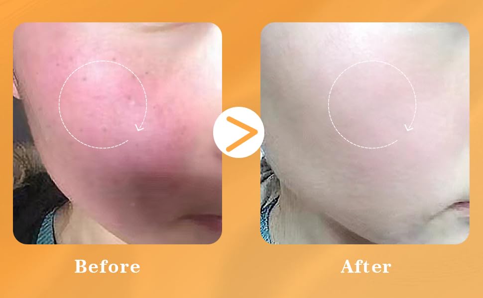 Suero facial liposomal con vitamina C, calmante instantáneo, calmante, iluminador, antienvejecimiento, tono de piel uniforme con centella asiática, ceramida, astaxantina y ácido hialurónico