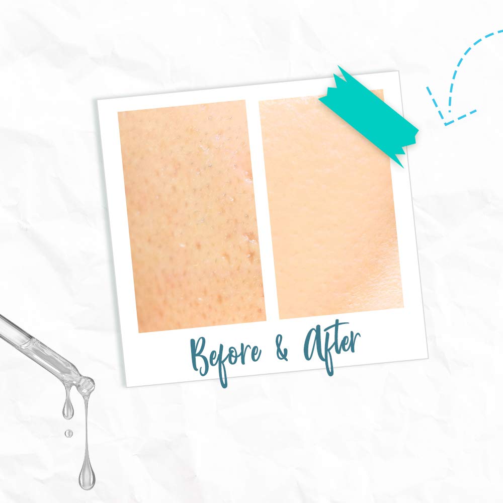 Skin Rescue Niacinamide Serum