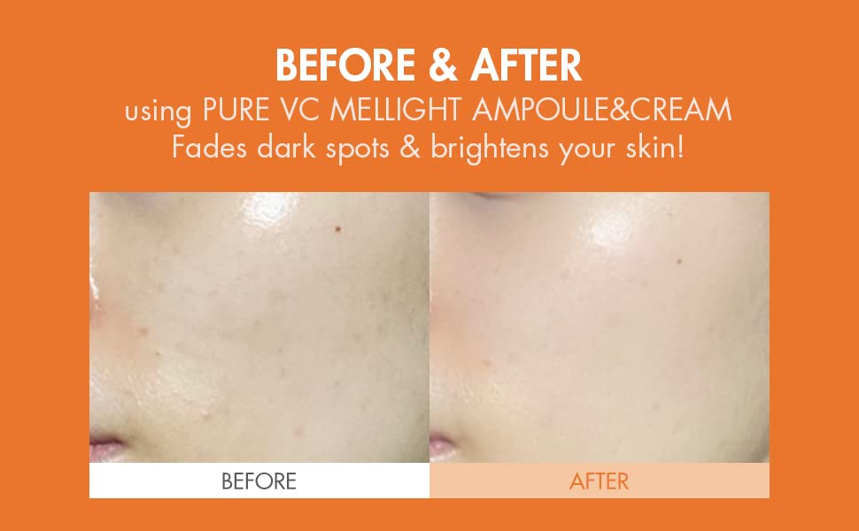 leegeehaam Dr.Ceuracle Pure Vitamin C Mellight CreamㅣTone-Up Serum for Face with Pure Vitamin CㅣAnti-Aging Moisturizer for Instant GlowㅣDark Spots, Wrinkles, & Sun Damaged SkinㅣParabens-Free