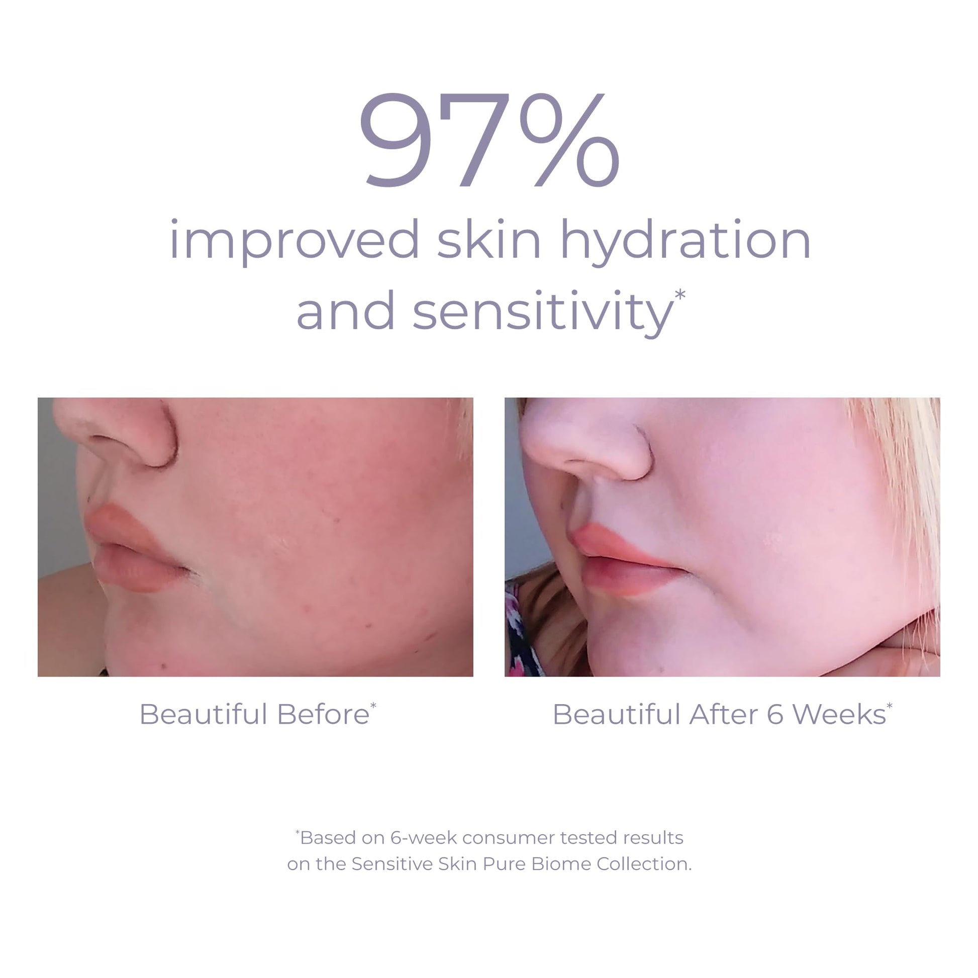 Derma-E Sensitive Skin Moisturizing Cream for Unisex 2 oz Cream