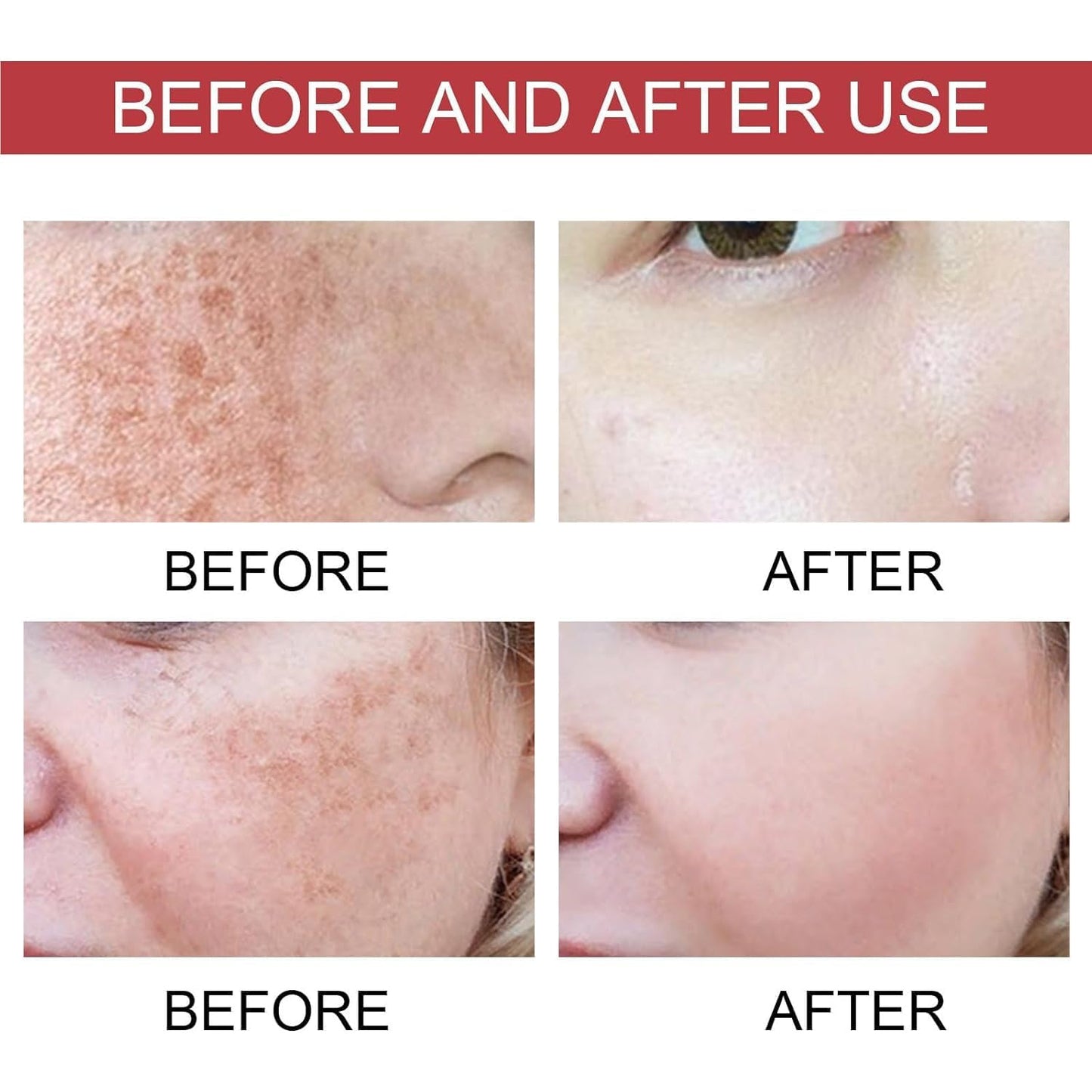 Upgraded Anti-𝐅𝐫𝐞𝐜𝐤𝐥𝐞 Essence Oil, 𝐁𝐫𝐢𝐠𝐡𝐭𝐞𝐧𝐢𝐧𝐠 𝐒𝐩𝐨𝐭 𝐂𝐨𝐫𝐫𝐞𝐜𝐭𝐢𝐧𝐠 Moisturizing Essence Water, Upgraded Body Care Essence Oil, Hydrates Skin Care & Improve Dry Skin Fair