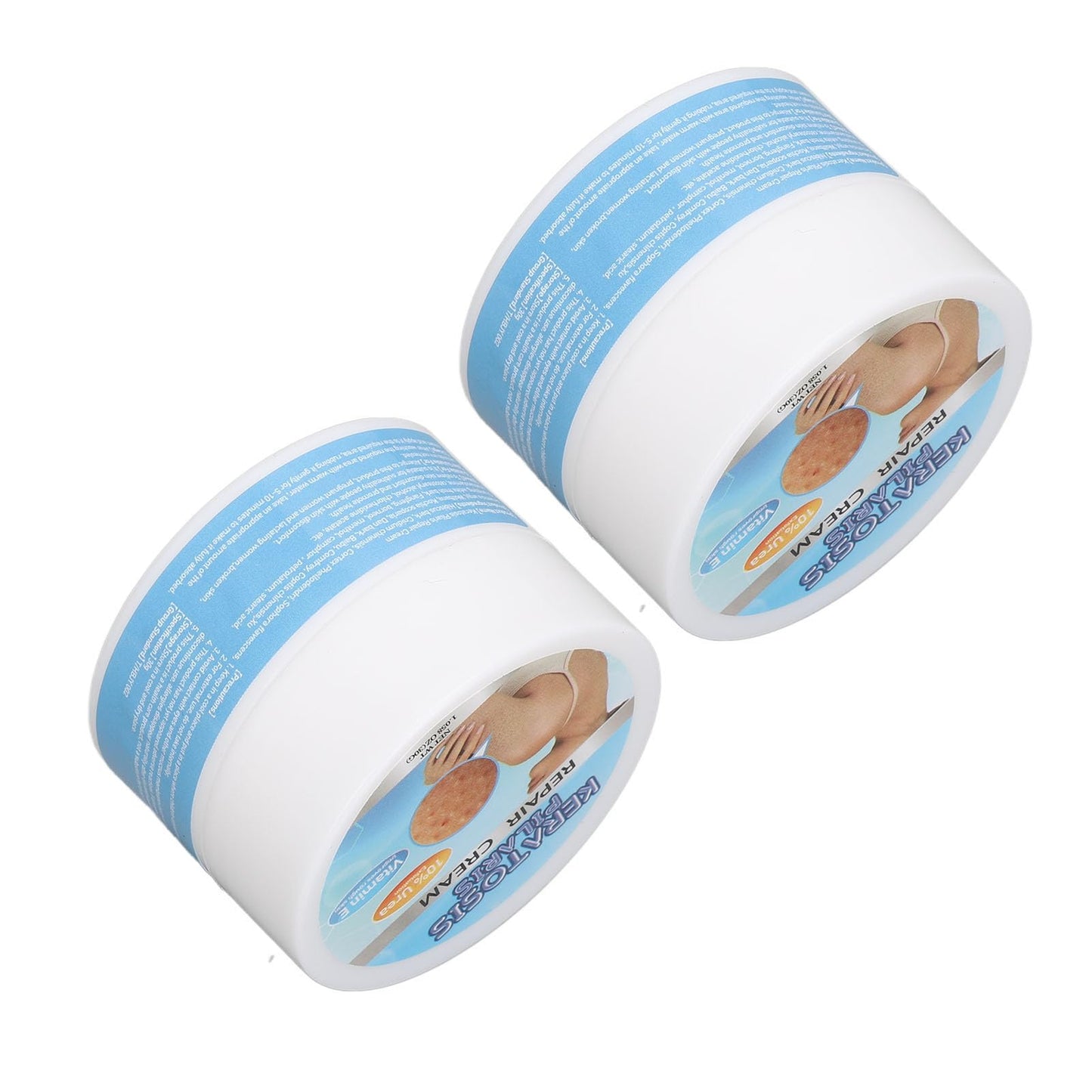 Crema de Queratosis para Suavizar la Piel, Borrador de Protuberancias, Exfoliación con Vitamina E - Solución Diaria para el Cuidado de la Piel, Material Orgánico, Alivio