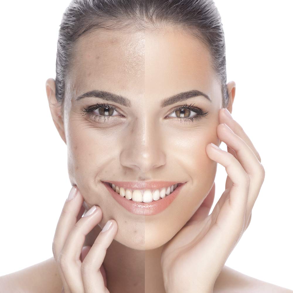 Babaria Serum Inteligente Antimanchas, Blanco, 30 Mililitros