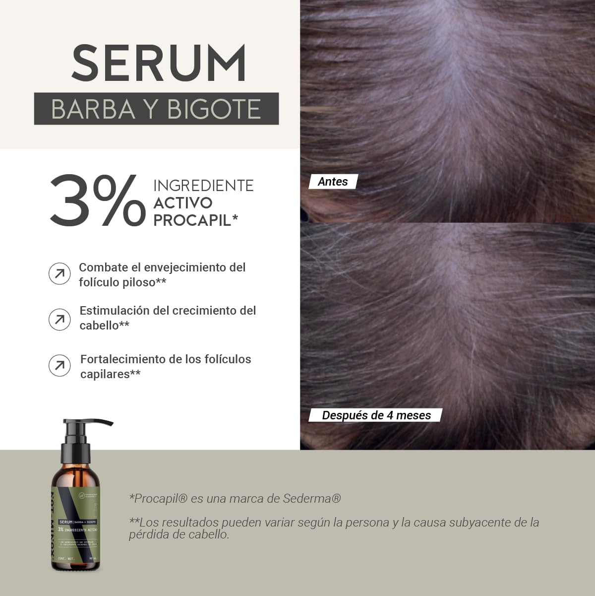 Serum para Crecimiento de Barba NOT-MINOX | Ingredientes Activos con Biotina y Vitamina E | para Barba Nula o Corta
