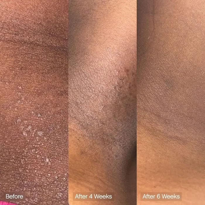 Topicals Jabón Limpiador Facial Y Corporal Faded | Ácido Kójico, Vitamina C Y Ácido Láctico | Hidrata | Vegano, Sin Perfume, Apto Para Pieles Sensibles (Paquete De 2)