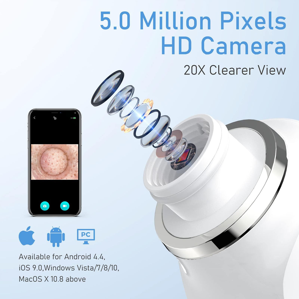 Aspirador de puntos negros faciales, cámara 1080p, zoom 20x, 8 LED y 3 modos de succión, batería 800 mAh y USB - Kit de limpieza de poros de 6 cabezas para hombres y mujeres (azul)