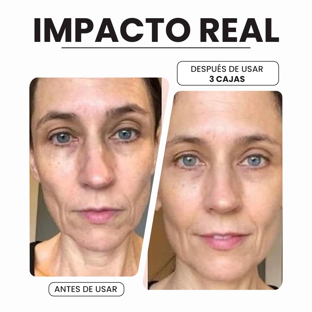 Seyoul™ DoC Retinol (1% Retinol), rejuvenecimiento de la piel, decoloración de las manchas oscuras, tono uniforme de la piel, 40 boidegradable capsules
