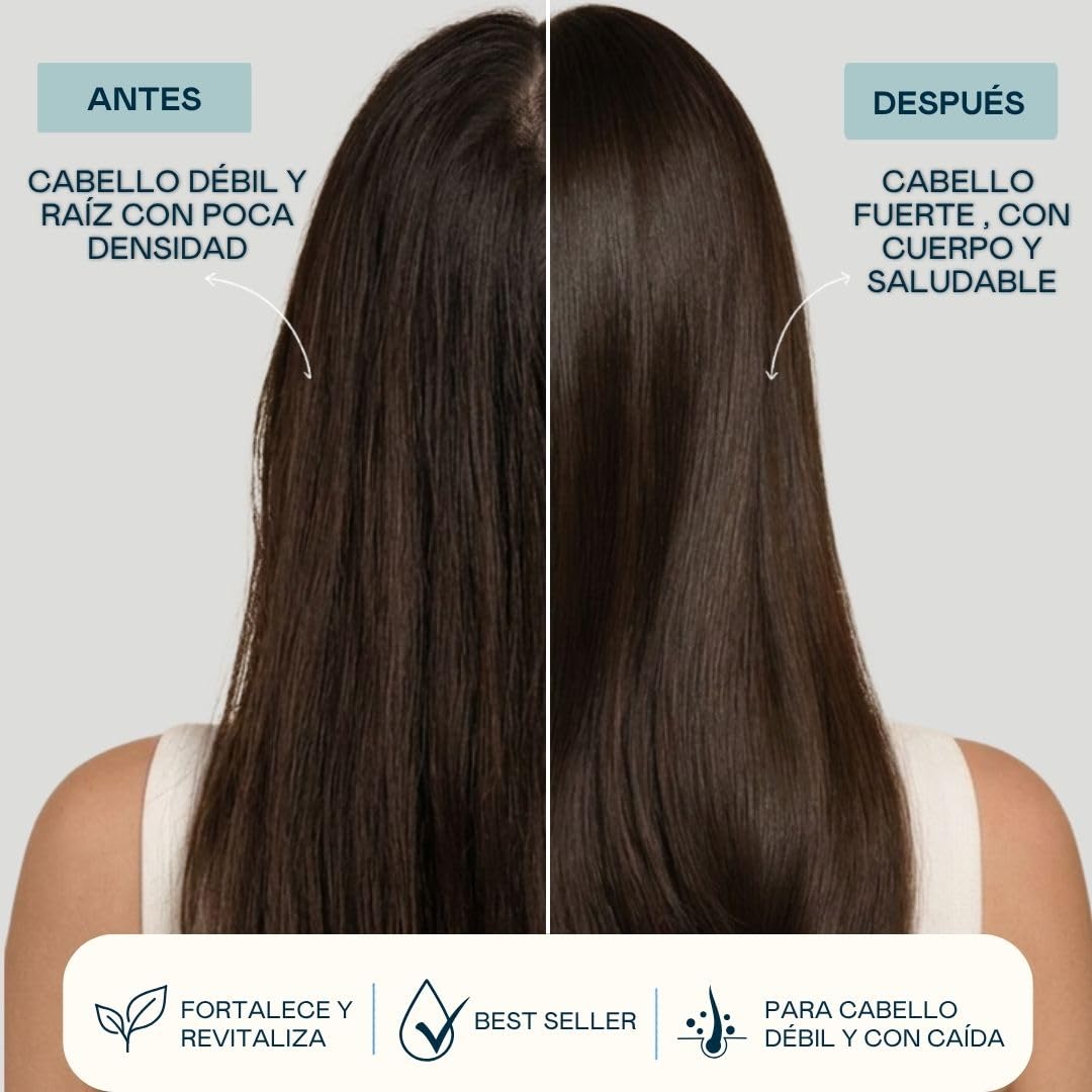 Loción Anticaída Valquer Shock Fórmula Zero 100 ml