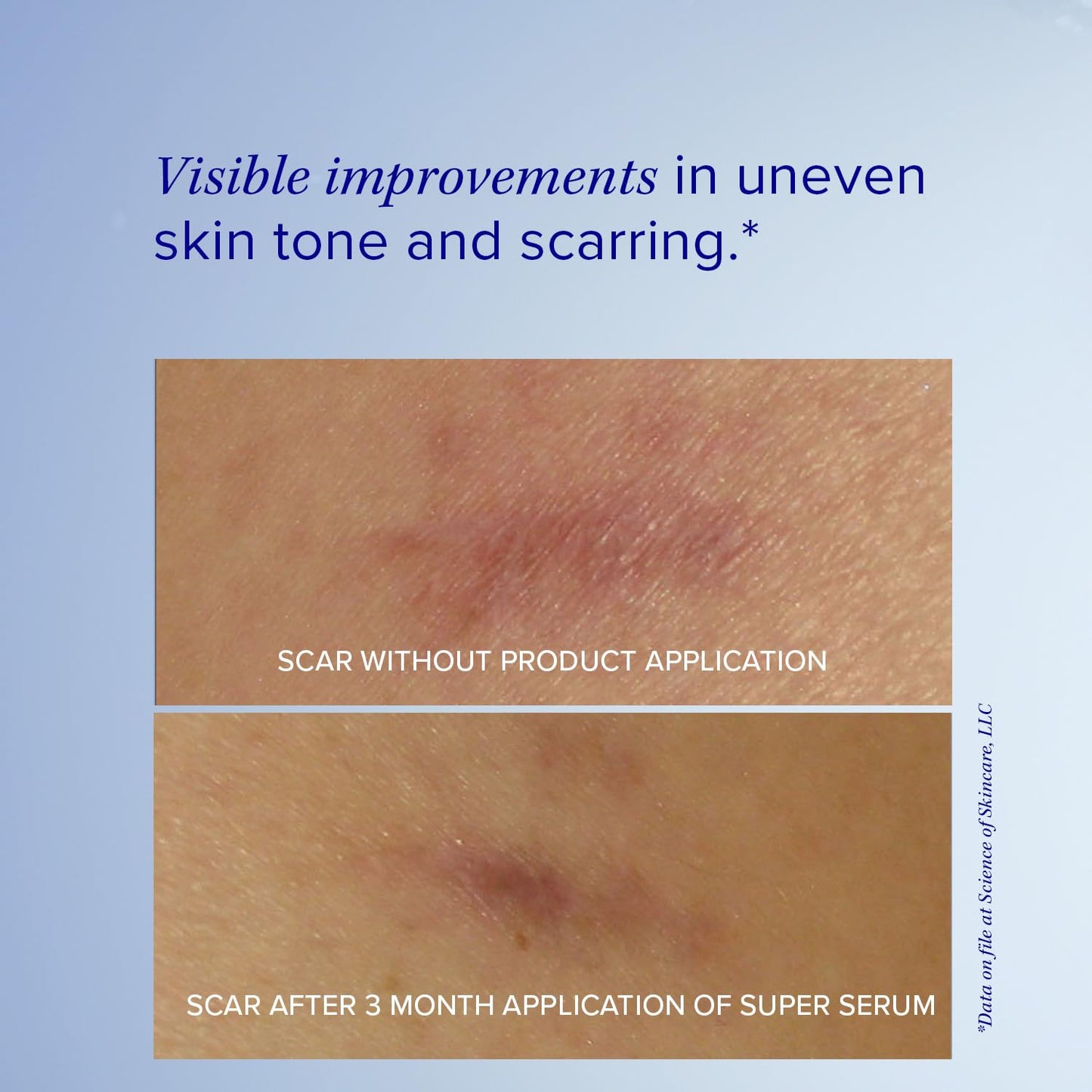 iS Clínica Super Serum Advance+, 29,57 ml