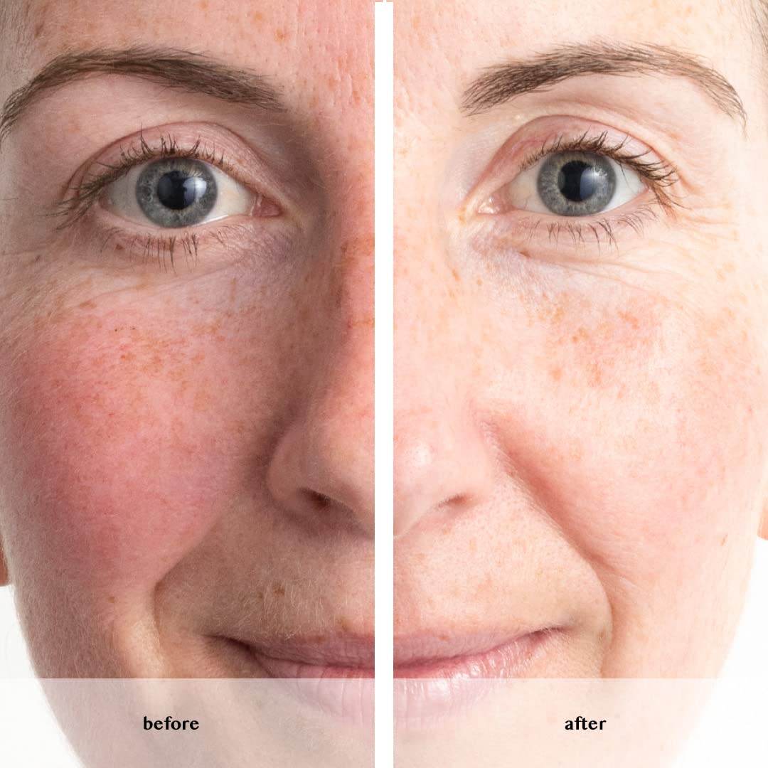 Serum ANEW Renewal de 30 ml: Potente Tratamiento Anti-Edad & Renovador cutáneo. ¡Dale a tu piel la juventud y luminosidad que merece!
