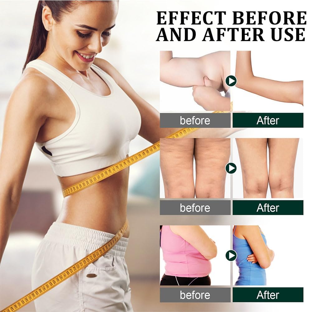 Conjunto de 5 productos para moldear tu cuerpo y tonificar la piel: Esencia reductora de 10 ml, Suero bloqueador de grasa y calorías de 10 ml, Aceite corporal de colágeno reafirmante, Suero reafirmante y tensor de la piel. ¡Descúbrelo!