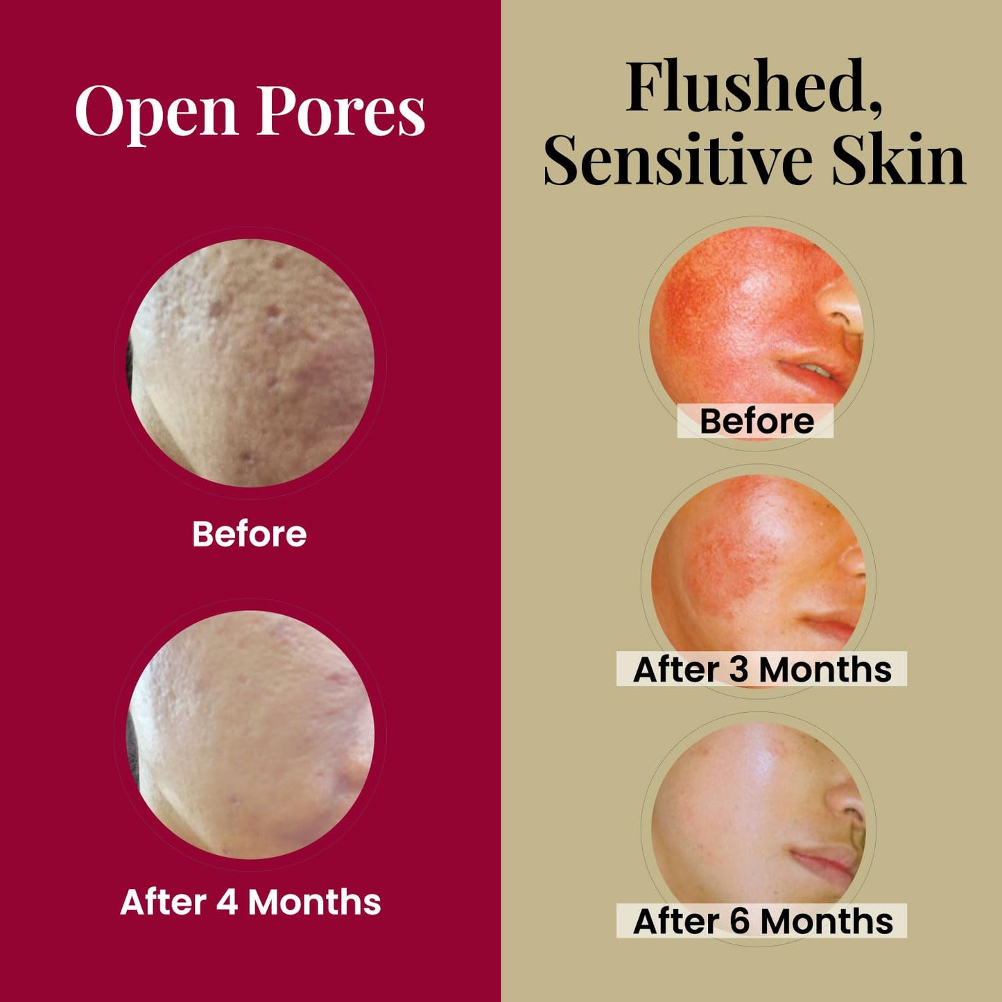 Le Revital 98% concentrado Nano Placenta, extracto umbilical e hialuronato de sodio suero antienvejecimiento de Japón – Rejuvenece la piel – Reduce las arrugas, manchas oscuras + hidratación – No graso