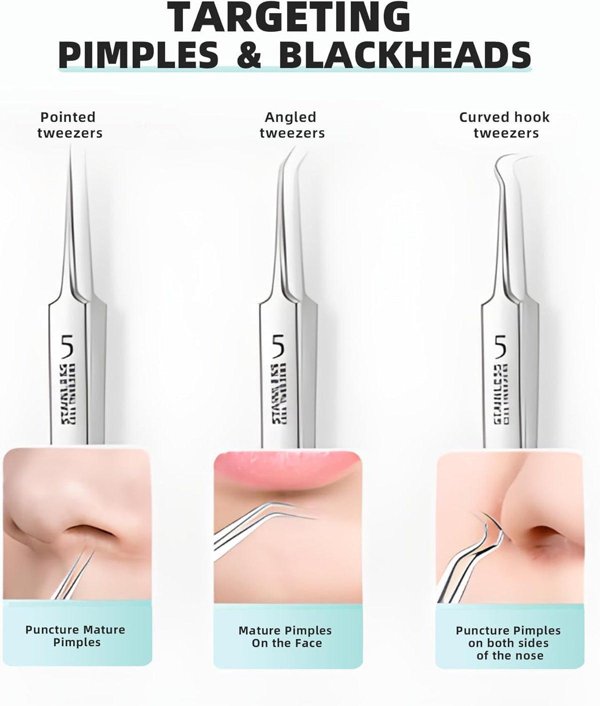 Kit de herramientas de eliminación de puntos negros de grado médico, herramienta de extracción de puntos negros, pinzas de puntos negros, kit de eliminación de etiquetas de piel para eliminar manchas