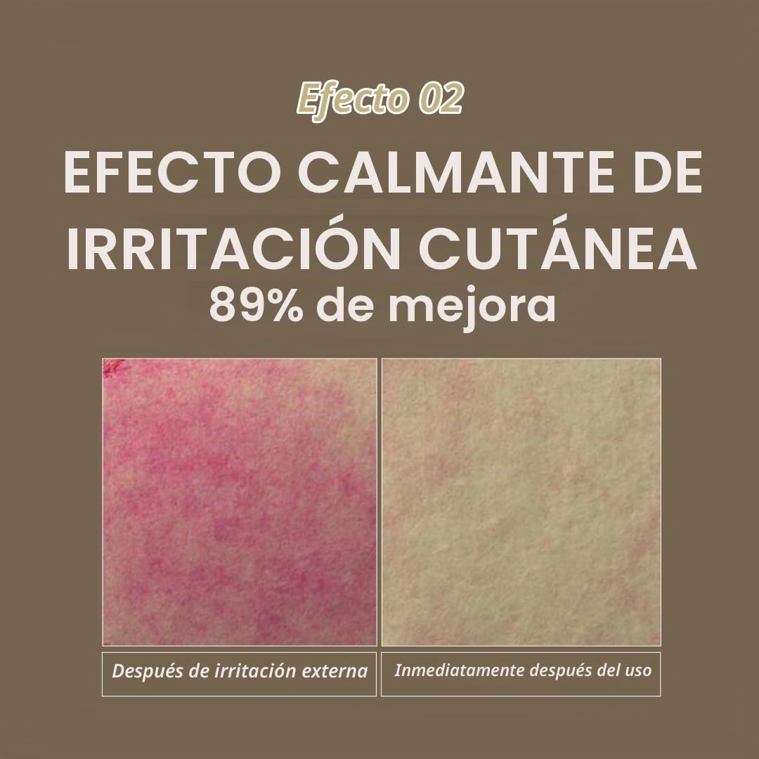 MIZON Crema Hidratante Facial All In One Snail Repair 35 ml - crema para la cara coreana con baba de caracol, skincare coreano día y noche, k beauty