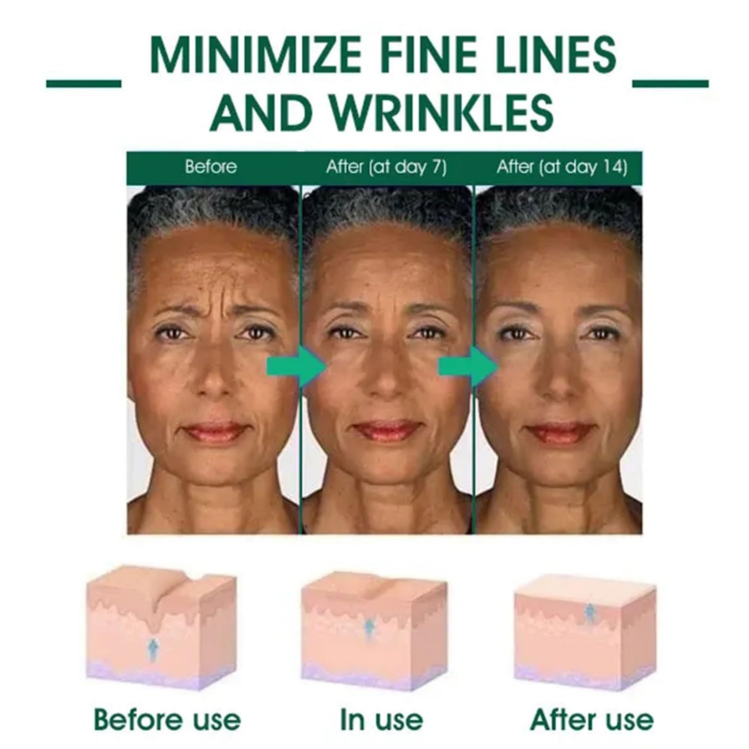 Suero Rejuvenecedor Reafirmante Para la Piel, Suero Reafirmante Para la Piel, Suero Facial de ácido Hialurónico, Lifting y Reafirmante, Reduce Pigmentación y Mejora el Tono