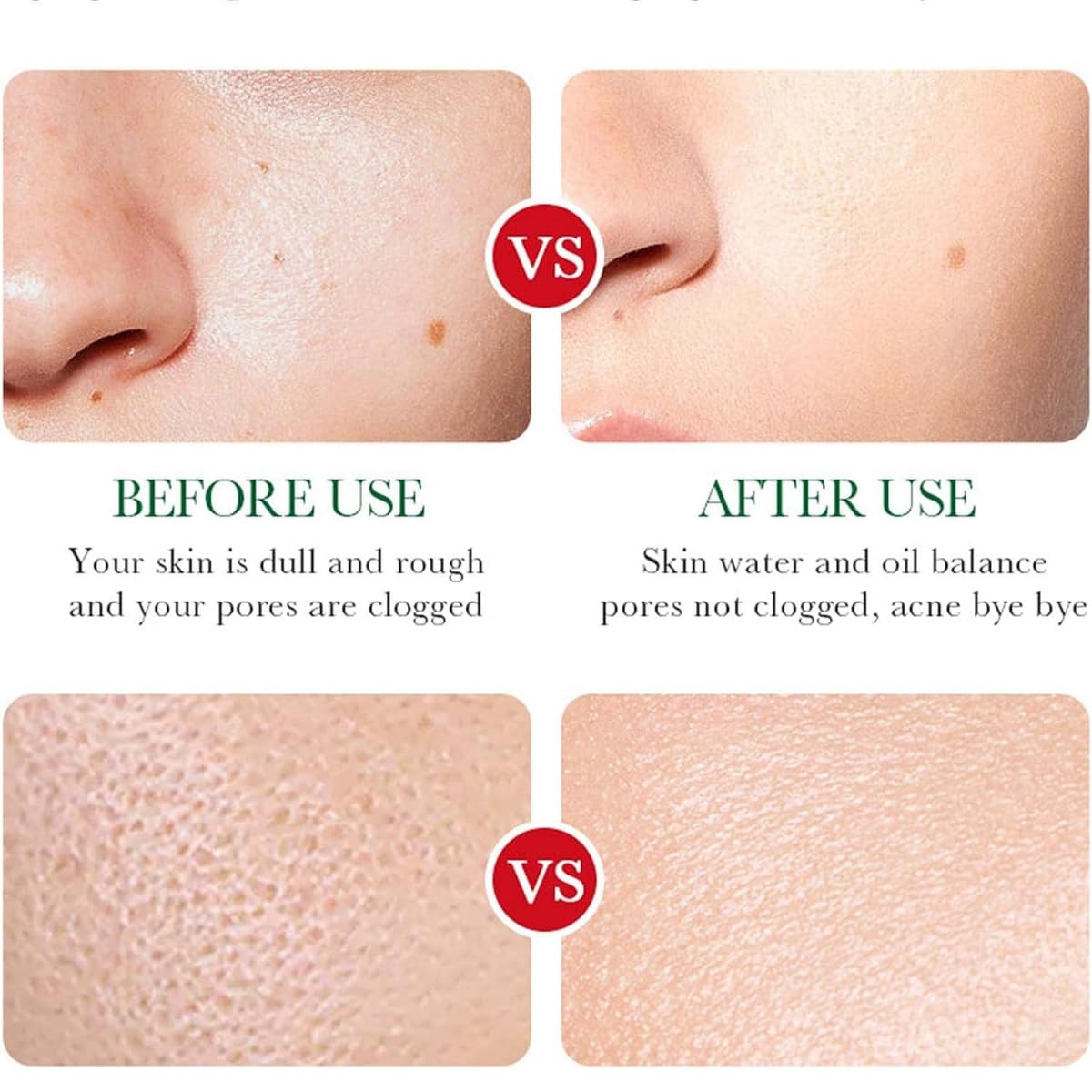 Trio Serum Hidratante Skin Care Alta Calidad Esencia Perilla Polipeptide + Sea Fennel Acido Hialuronico + Acido Salisilico Removedor Acne Cuidado De la Piel