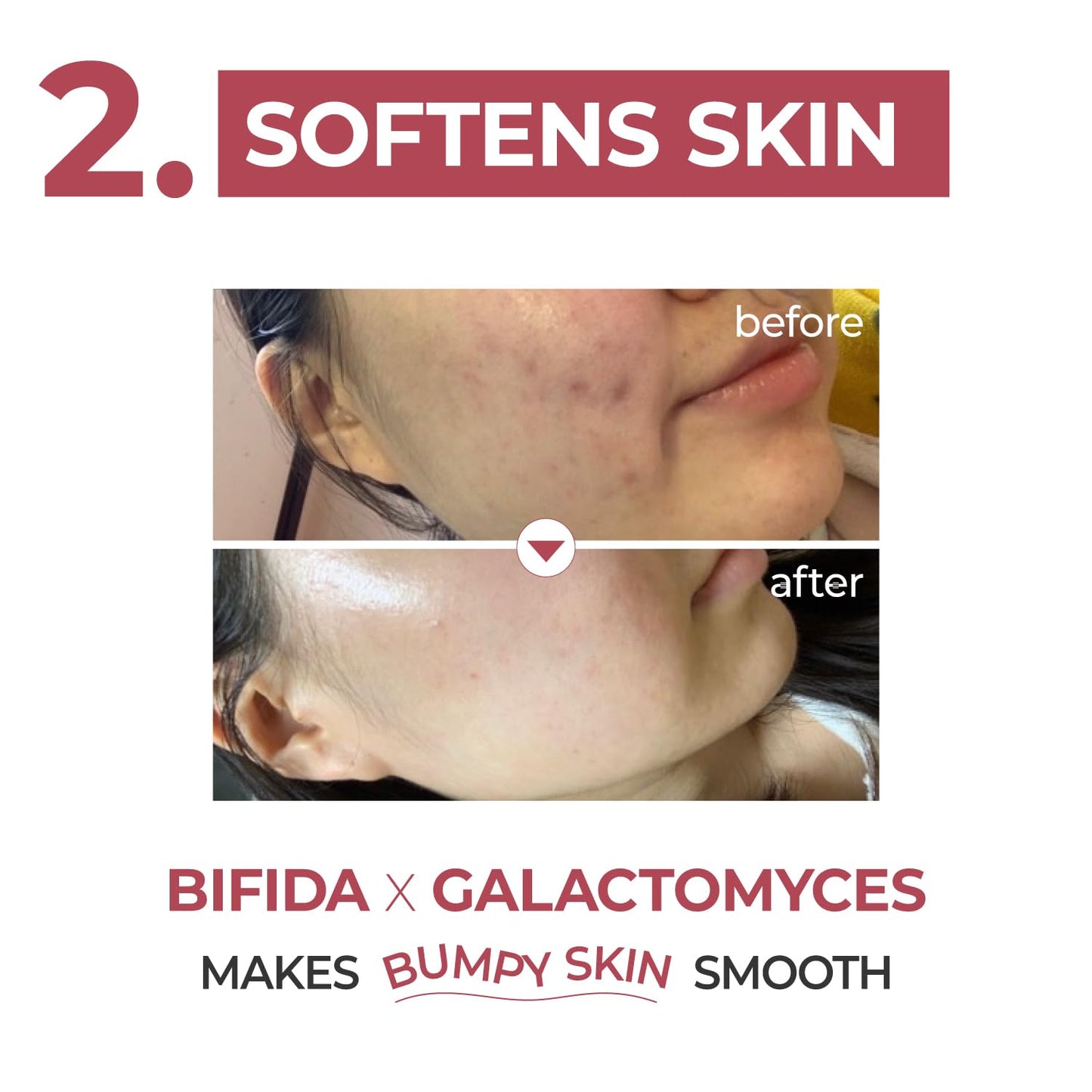 [Numbuzin] No.3 Skin Softening Serum 50ml.