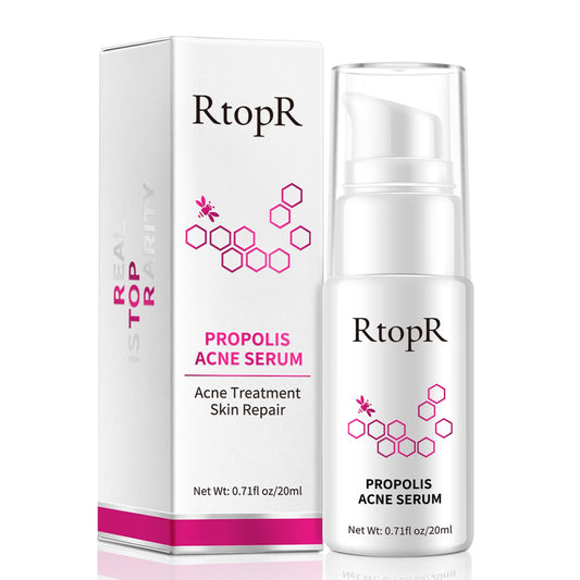 RtopR Propolis Repair Acne Serum, Suero Hidratante Anti-Acné para Eliminar el Acné Severo, Brotes, Granos y Reparar la Piel