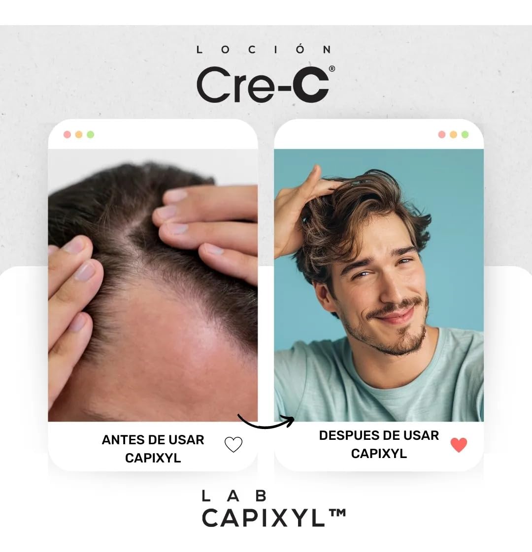 Loción Regeneradora Capilar Cre-C Lab Capixyl Con Extractos Naturales Anticaída Previene Envejecimiento