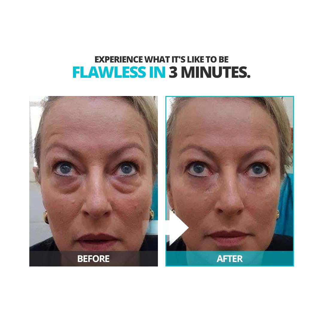 Instantly Ageless Facelift in A Box - 1 Box of 25 Vials