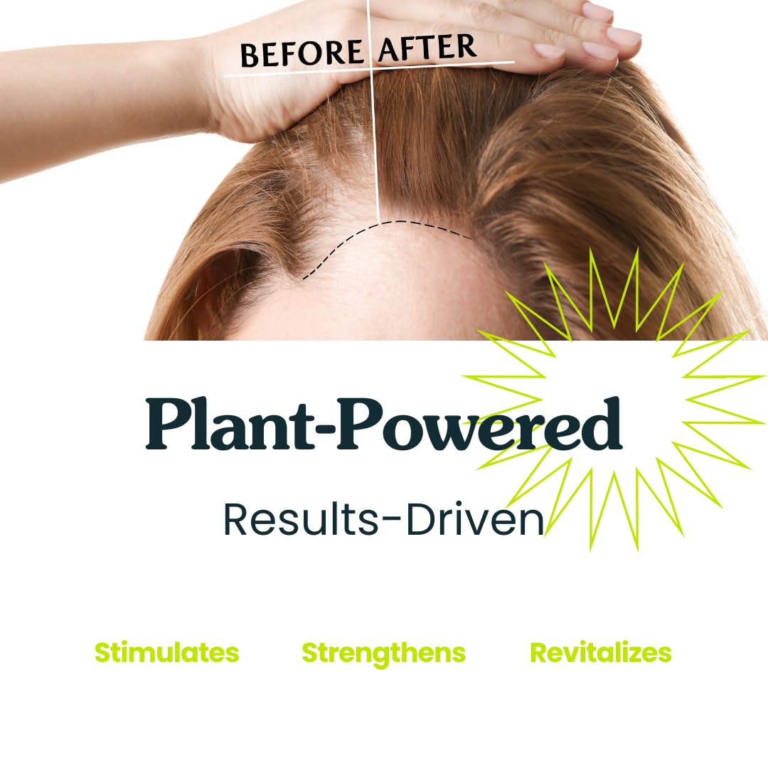 Aceite de Crecimiento del Cabello Clearly GAIN Natural con Ricino Salvia Romero para Cabello Debilitado en Hombres y Mujeres