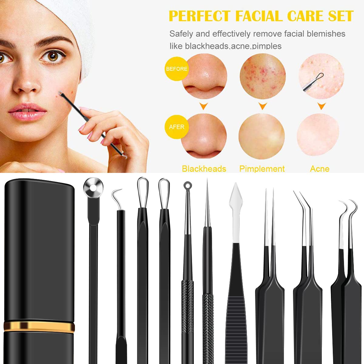 Kit de herramientas de extracción de espinillas, de acero inoxidable, extractor de comedones, para frente, nariz, ligera, con funda de metal para viajes, uso doméstico