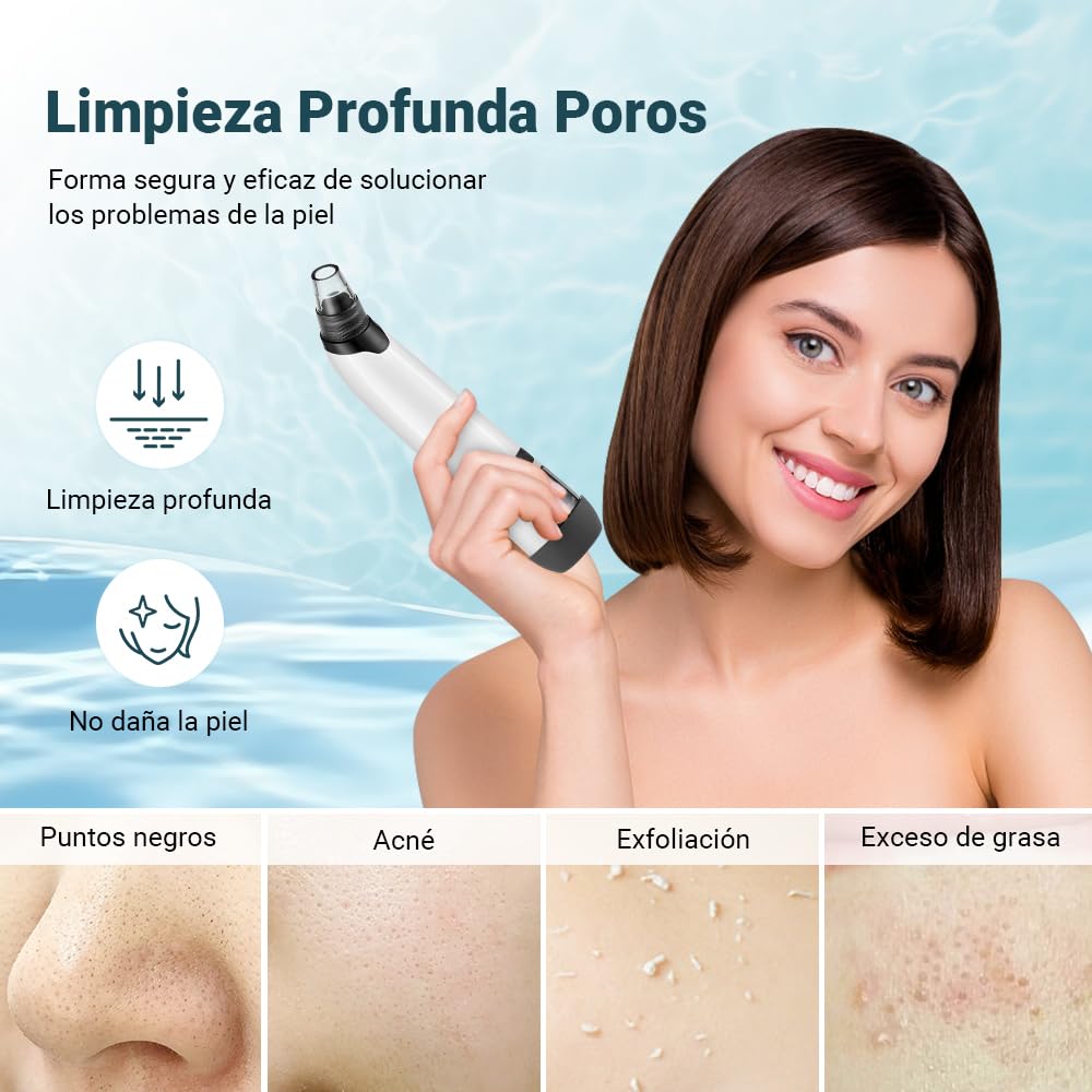 MITEGELO Removedor de Espinillas, Succionador de Puntos Negros