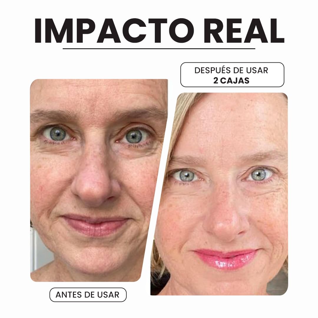 Seyoul™ DoC Retinol (1% Retinol), rejuvenecimiento de la piel, decoloración de las manchas oscuras, tono uniforme de la piel, 40 boidegradable capsules