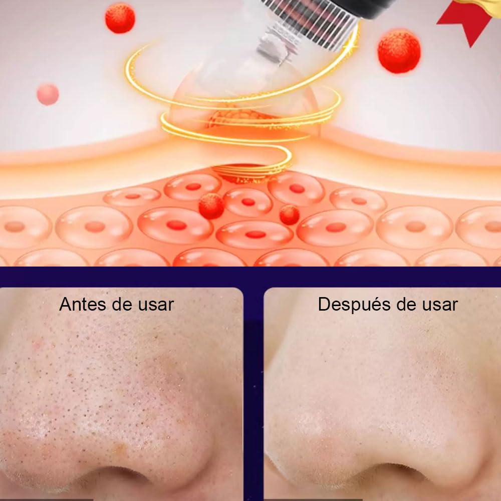 11 en 1 Máquina Facial de Oxígeno de Hidrógeno, Dispositivos de Belleza de Rociador de Pie con Rueda, Diamante Dermoabrasión, Máscara Facial LED,para Mejorar de los Dispositivos de Celulitis