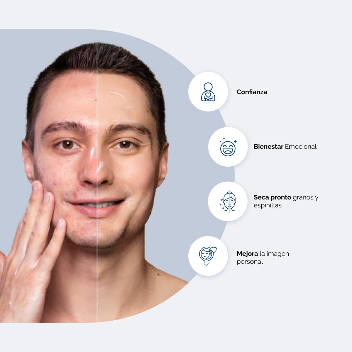 BPO LLEN Gel Limpiador Facial Anti-Acné con Peróxido de Benzoilo 5% | Tratamiento Anti-Imperfecciones | Antiseborreico y Antiséptico | Indicado para Combatir el Acné Leve o Moderado | 60 ml