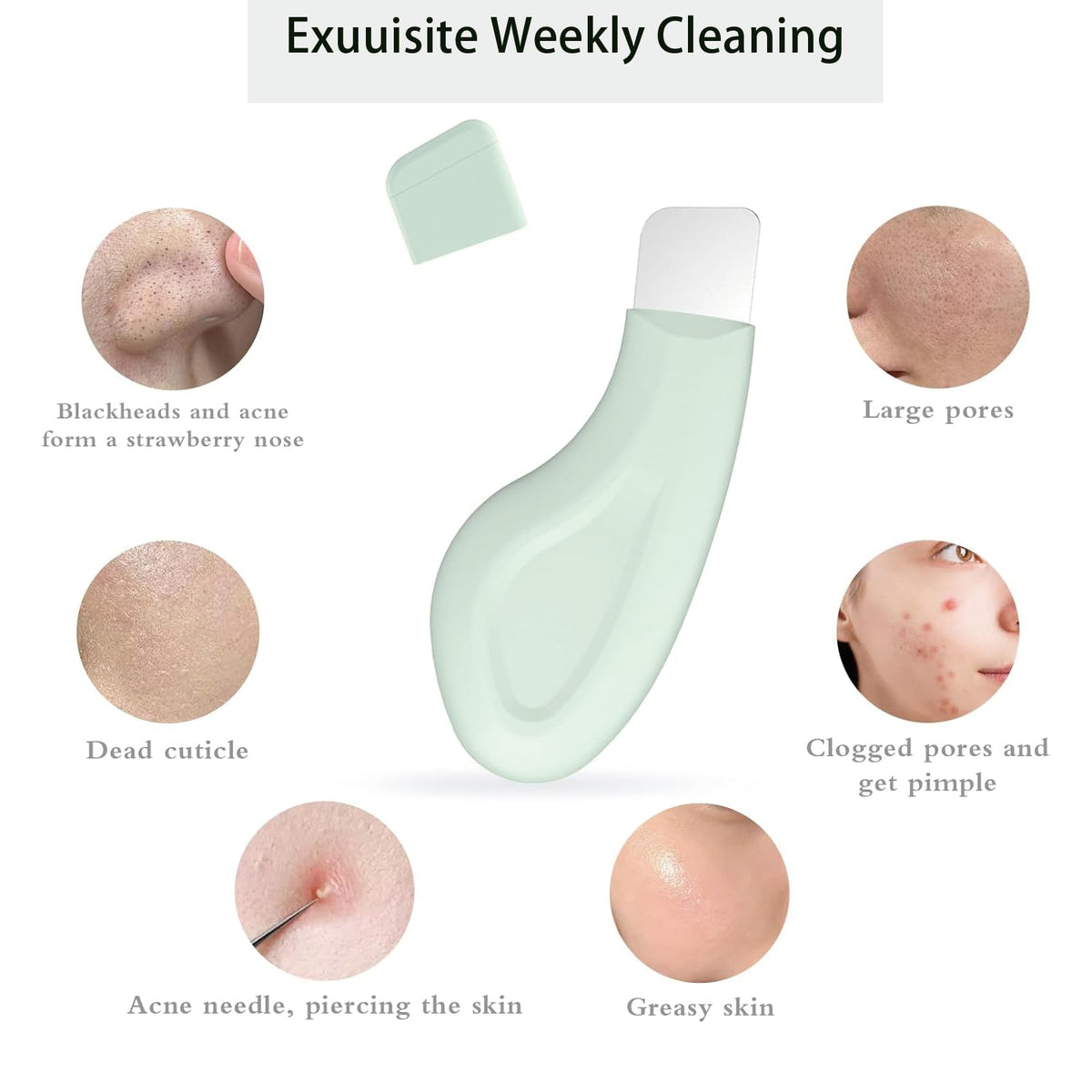 Paquete de 2 herramientas para eliminar puntos negros, rascador facial para limpieza profunda de nariz, espinillas, herramienta de exfoliación suave y segura, herramienta de cuidado de la piel para