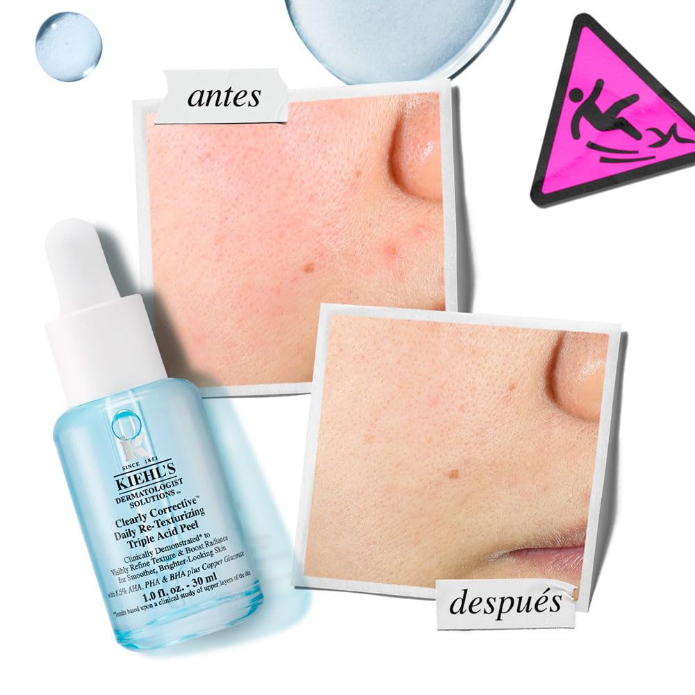 Kiehl's, Set Best in Glass, Set de Regalo, Clearly Corrective Daily Re-Texturizing Triple Acid Peel 30ml + Clearly Corrective Dark Spot Solution 15 ml, Un Dúo contra las Manchas Oscuras para Revelar una Piel Luminosa, 2 Piezas