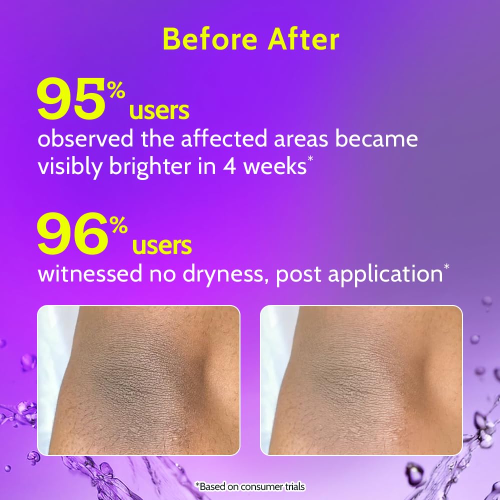 Chemist at Play Brightening & Whitening Roll On Serum For Neck, Knee & Elbow With 6% Vitamin C+ Hyaluronic Acid + AHAs + Niacinamide + Ceramides | Exfoliates, Removes Pigmentation, Brightens Skin & Hydrates Dry Skin | 40ml