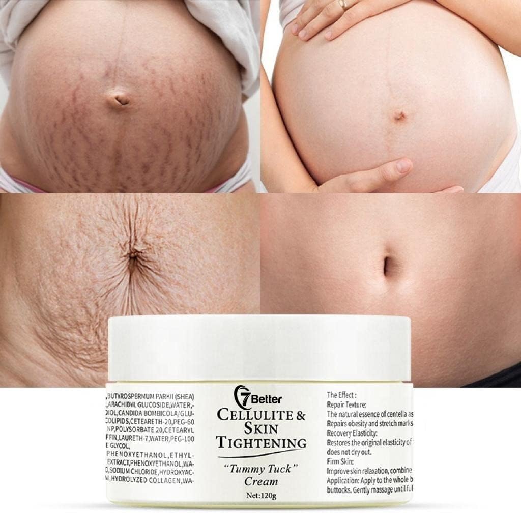7better LLC Crema Remoción de Estrías y Cicatrices para El Embarazo - Reparación de Cicatrices, Reafirmante Abdominal, y Suave Erradicación de Estrías Cuidado de La Piel Cuerpo
