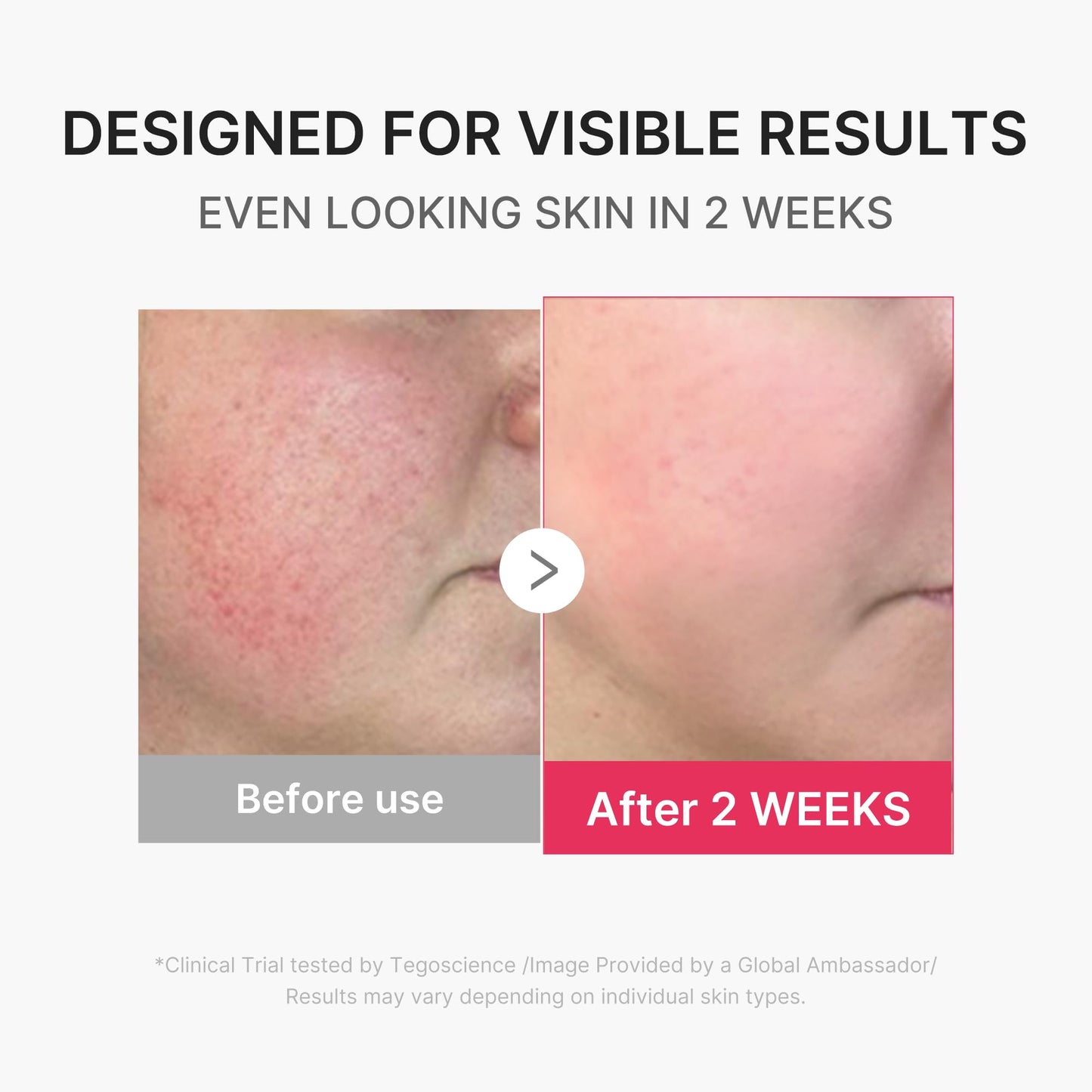 medicube Mini Booster Pro Plus | Dispositivo facial para una piel radiante, calmante y con aspecto rejuvenecido | Modo rojo, azul, púrpura 3 en 1 | Dispositivo portátil de cuidado de la piel coreano