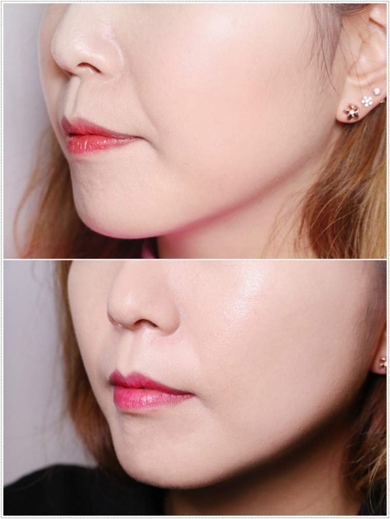 Medi-Peel Peptide 9 Esencia de volumen, 100 ml | Tratamiento de colágeno para flacidez de la piel con fórmula hidratante concentrada