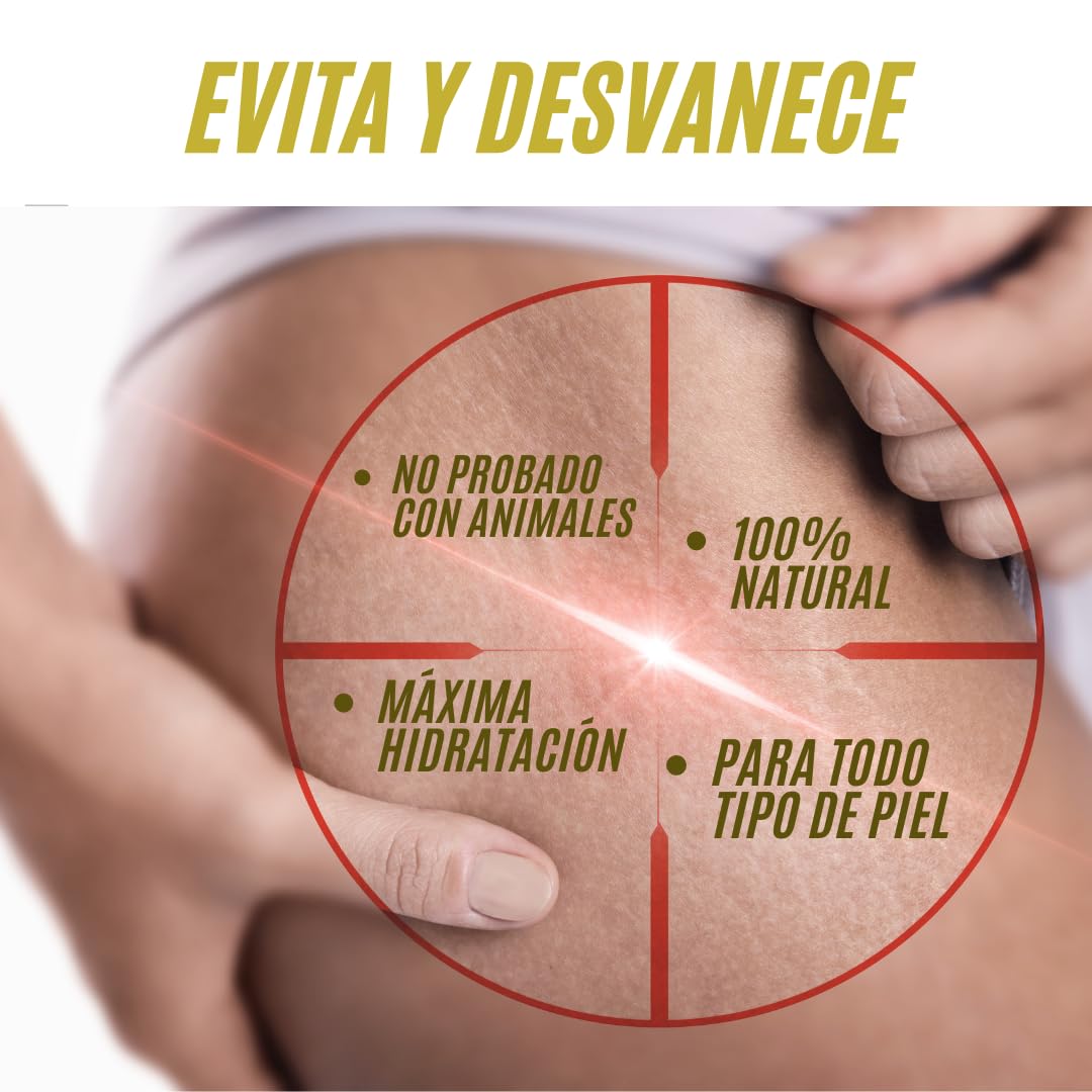 SKIN NATURAL - Aceite Corporal 250 ml - Previene, Atenua, y Disminuye, Estrías, Celulitis, Cicatrices, Imperfecciones e Impurezas - Oil 100% Natural, ideal para Embarazadas, Dietas, y Deportistas