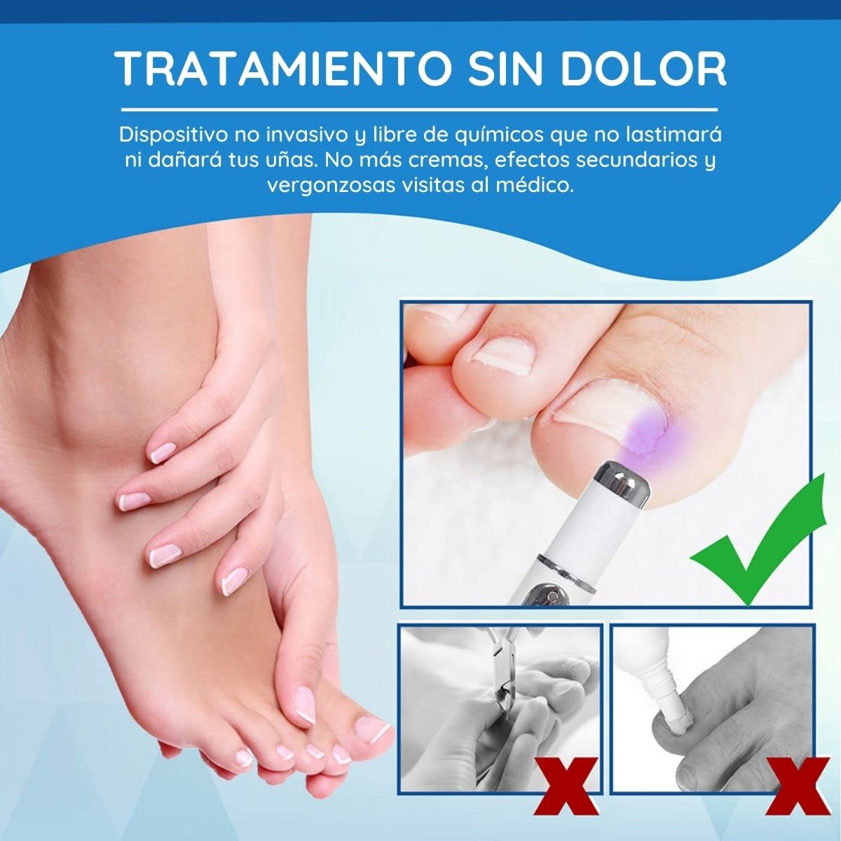EELHOE Bolígrafo Luz Azul para Tratamiento de Hongos en Uñas - Elimina Onicomicosis y Paroniquia