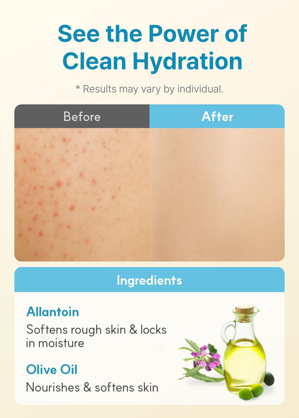 Derma B Loción corporal diaria de humedad 400 ml