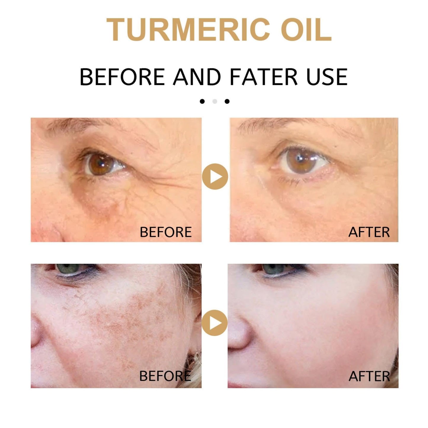 Cúrcuma Serum Facial Reparador, Suero Corrector De Manchas Oscuras De Cúrcuma, Cúrcuma Natural Piel Brillante Suero Hidratante Reparador de Manchas Oscuras, Hidrata La Piel Apagada Y Seca (3PCS)