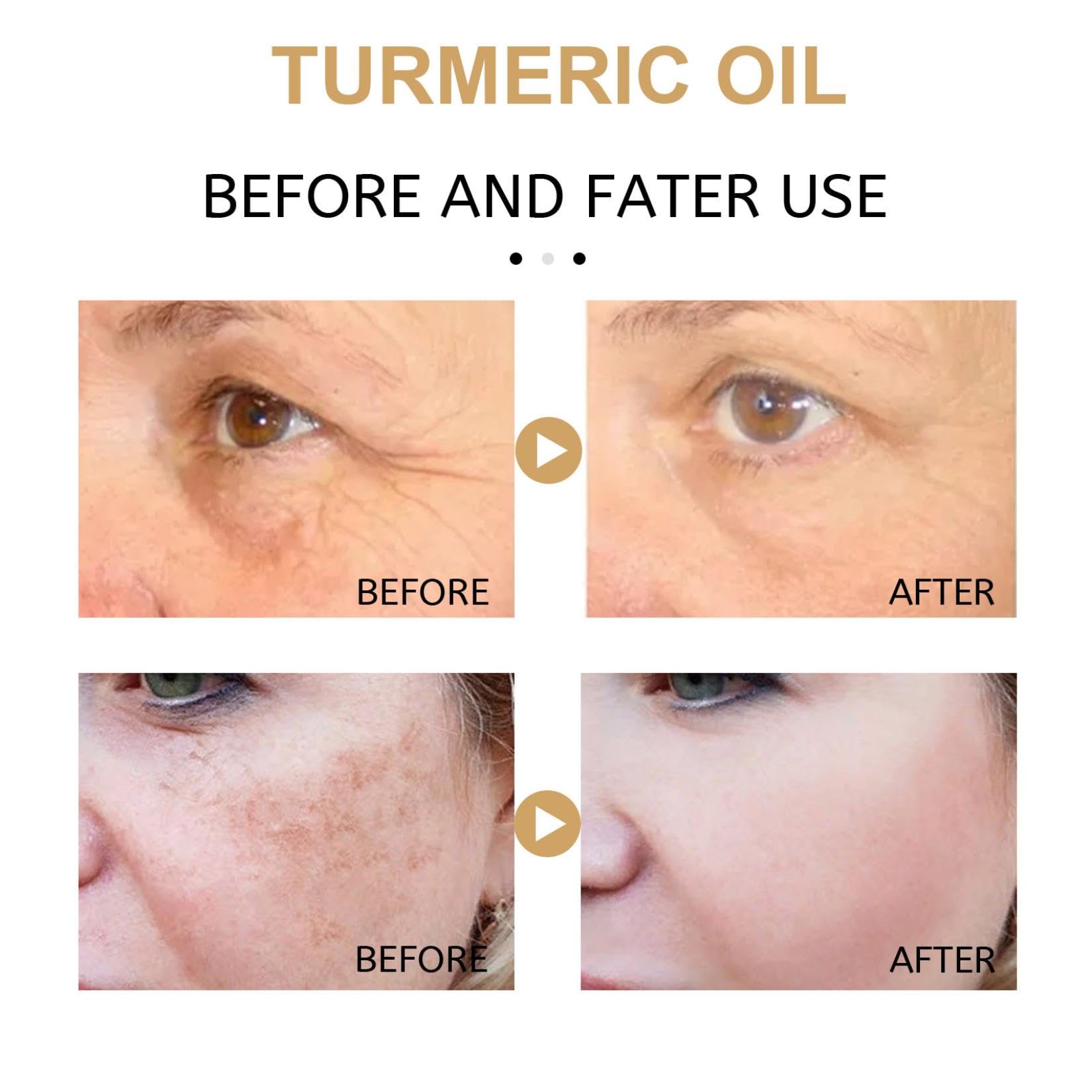 Cúrcuma Serum Facial Reparador, Suero Corrector De Manchas Oscuras De Cúrcuma, Cúrcuma Natural Piel Brillante Suero Hidratante Reparador de Manchas Oscuras, Hidrata La Piel Apagada Y Seca (3PCS)